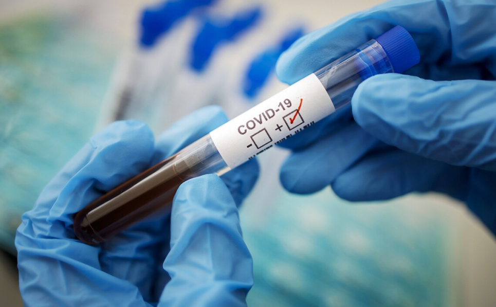 В Україні з жовтня зафіксовано 343 летальні випадки від COVID-19 В Україні з жовтня зафіксовано 343 летальні випадки від COVID-19