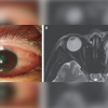 Фото: New England Journal of Medicine