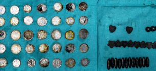 Из кишечника делийца хирурги извлекли 39 монет и 37 магнитов 