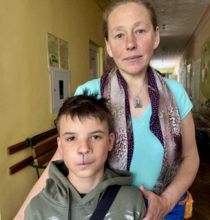 Львівські лікарі виправили вроджену ваду обличчя хлопчику-сироті 