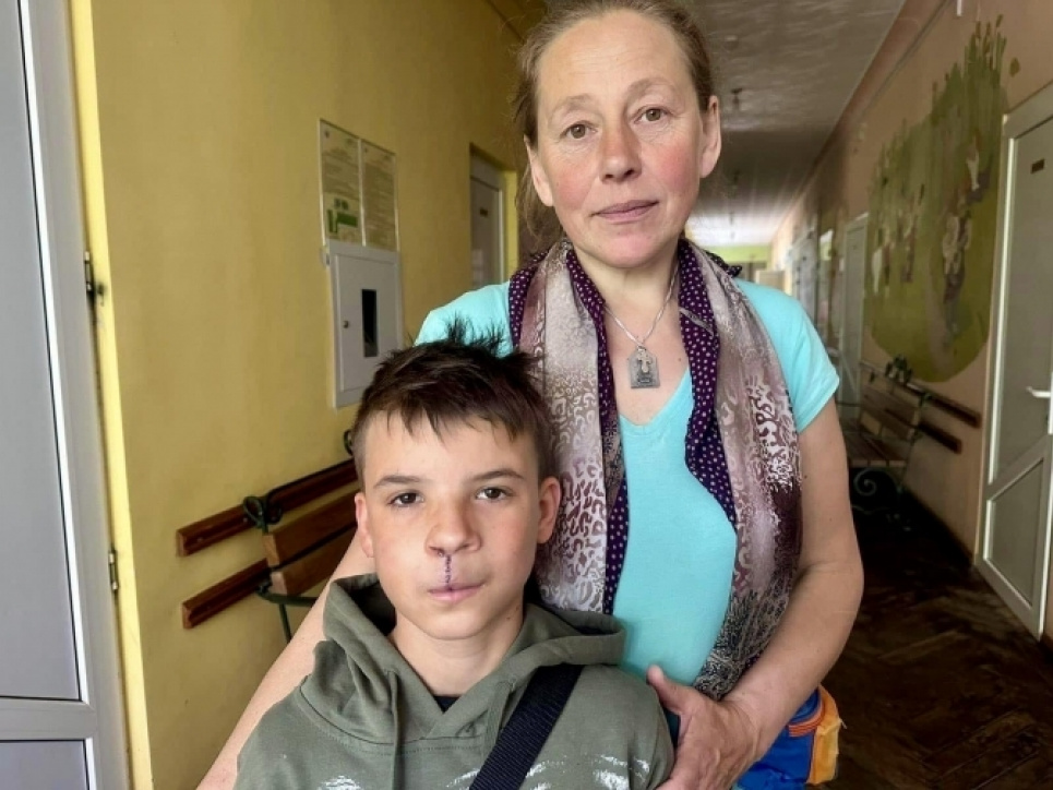 Львівські лікарі виправили вроджену ваду обличчя хлопчику-сироті Львівські лікарі виправили вроджену ваду обличчя хлопчику-сироті
