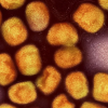Кольорова трансмісійна електронна мікрофотографія частинок вірусу Mpox. Фото: Niaid/Niaid/dpa