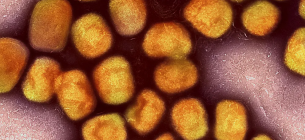 Кольорова трансмісійна електронна мікрофотографія частинок вірусу Mpox. Фото: Niaid/Niaid/dpa