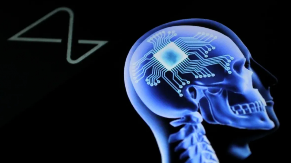 Neuralink продовжує вживляти нейрочипи у мозок людини Neuralink продовжує вживляти нейрочипи у мозок людини