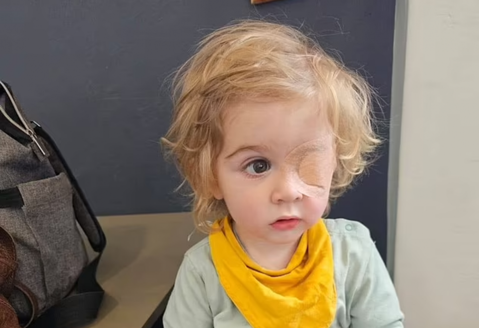 Дитина осліпла на одне око, коли її поцілував дорослий із герпесом: мати застерігає інших батьків (ФОТО) Фото: Facebook / Michelle Saaiman