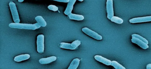 Електронна мікрофотографія Salmonella enterica серовару Thyphimurium. Фото: HZI/Manfred Rohde