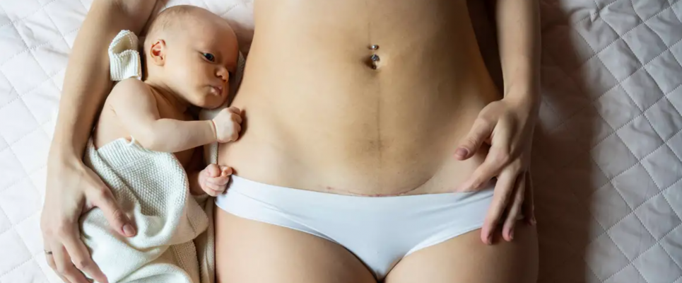 Туреччина заборонила планові кесареві розтини У Туреччині заборонили планові кесареві розтини: реакція суспільства. Фото: Nina Janeckova/Westend61/IMAGO