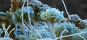 Грибок Aspergillus flavus. Джерело фото: Eye of Science