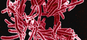 Туберкулез: от болезни бедных до вызова богачам? Фото: Cdc.gov