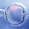 Фото: Aadorafertility.com.au