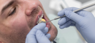 Противопоказания к установке зубной коронки: что нужно знать 