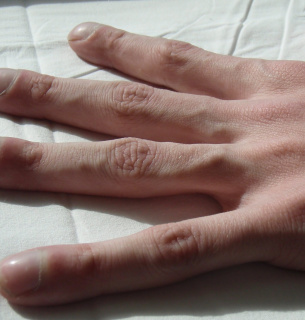 Європейський день муковісцидозу 2025 — підвищення обізнаності. Фото: Jerry Nick, M.D.