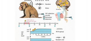 Лечение Альцгеймера звуком 40 Гц: эксперимент на макаках