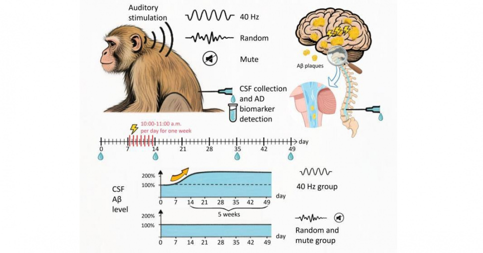 Лечение Альцгеймера звуком 40 Гц: эксперимент на макаках