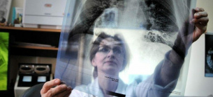 Всемирный день борьбы с туберкулезом: симптомы, лечение и роль фтизиатра