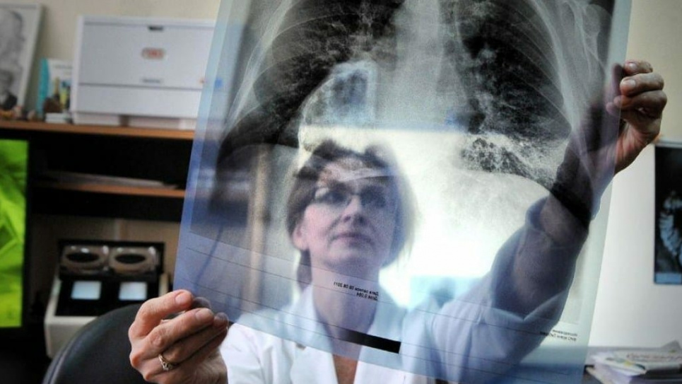 Всесвітній день боротьби з туберкульозом: симптоми, лікування та роль фтизіатра