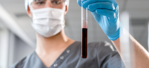 Системная красная волчанка: как проявляется это аутоиммунное заболевание и почему его трудно диагностировать